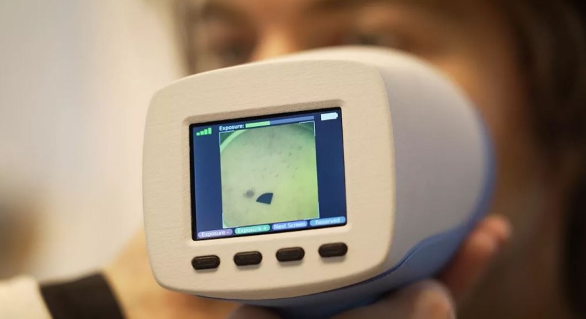 რამდენად გადაჭრის ახალი სკანერი კანის კიბოს დიაგნოსტიკის პრობლემას?