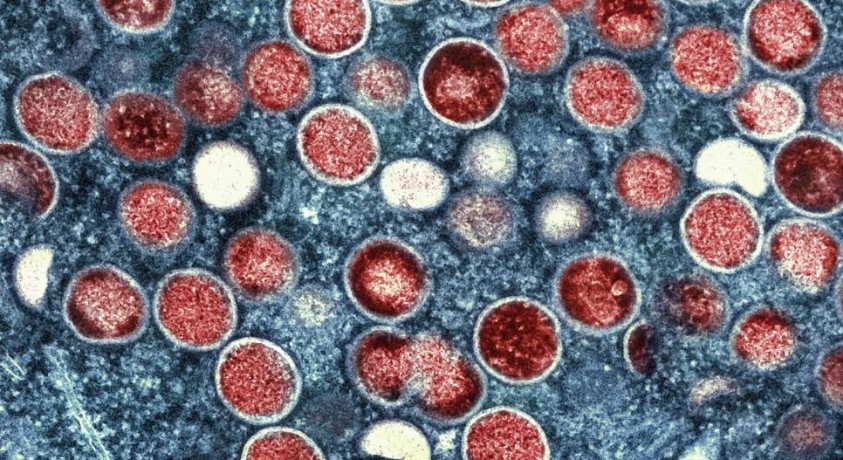 ჯანმომ „მაიმუნის ყვავილის“ ეპიდემიის გამო საგანგებო მდგომარეობა გამოაცხადა