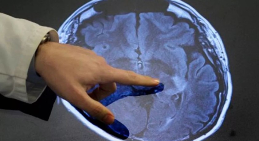 თბილისში „ინსულტის მსოფლიო ორგანიზაციის” საერთაშორისო კონფერენცია მიმდინარეობს