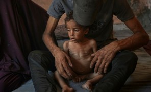 ღაზაში ჰუმანიტარული კრიზისის გამო უამრავი ადამიანი შიმშილობს