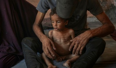 ღაზაში ჰუმანიტარული კრიზისის გამო უამრავი ადამიანი შიმშილობს