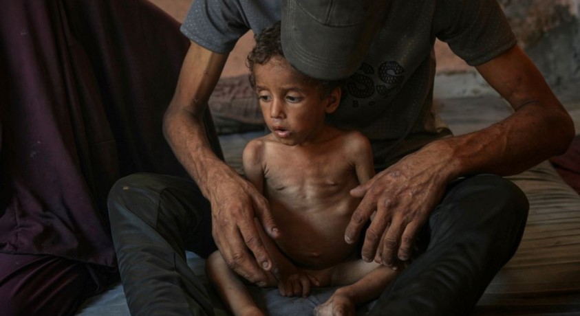 ღაზაში ჰუმანიტარული კრიზისის გამო უამრავი ადამიანი შიმშილობს