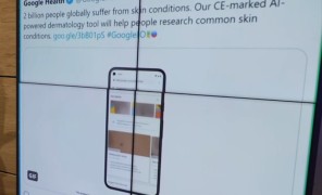 Google-ის ხელოვნური ინტელექტი, რომელიც კანის დაავადებებს ამოიცნობს