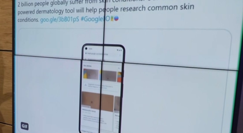 Google-ის ხელოვნური ინტელექტი, რომელიც კანის დაავადებებს ამოიცნობს