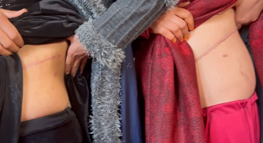 ავღანელები საკვების საშოვნელად ორგანოებს ყიდიან