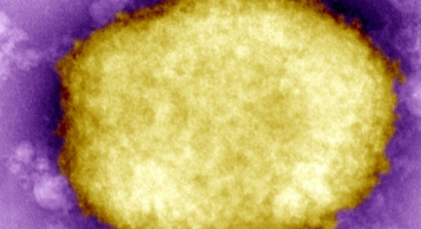 NCDC: საქართველოში „მაიმუნის ყვავილის” პირველი შემთხვევა დადასტურდა