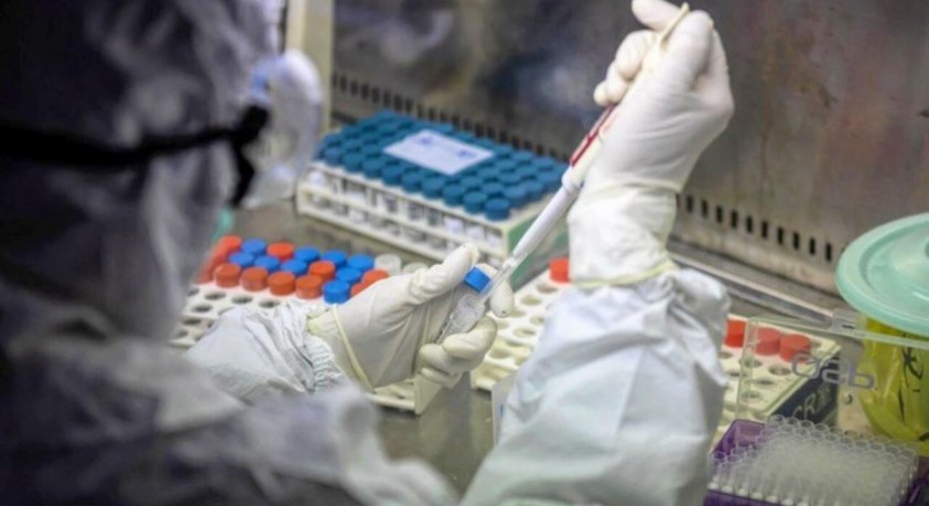 საქართველოში კოვიდგადატანილ პაციენტებს გამოიკვლევენ