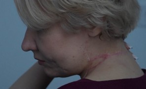 მარიუპოლელი ექიმები საავადმყოფოში განვითარებულ მოვლენებს იხსენებენ