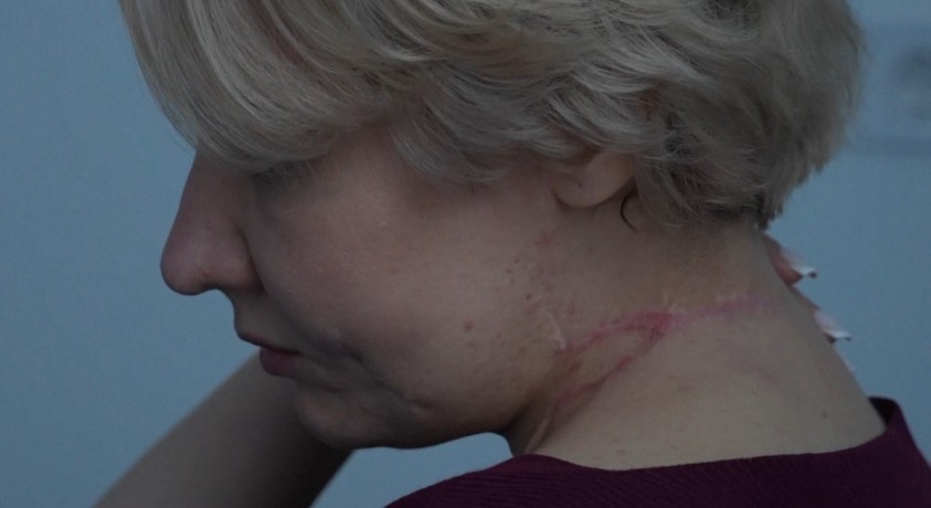 მარიუპოლელი ექიმები საავადმყოფოში განვითარებულ მოვლენებს იხსენებენ