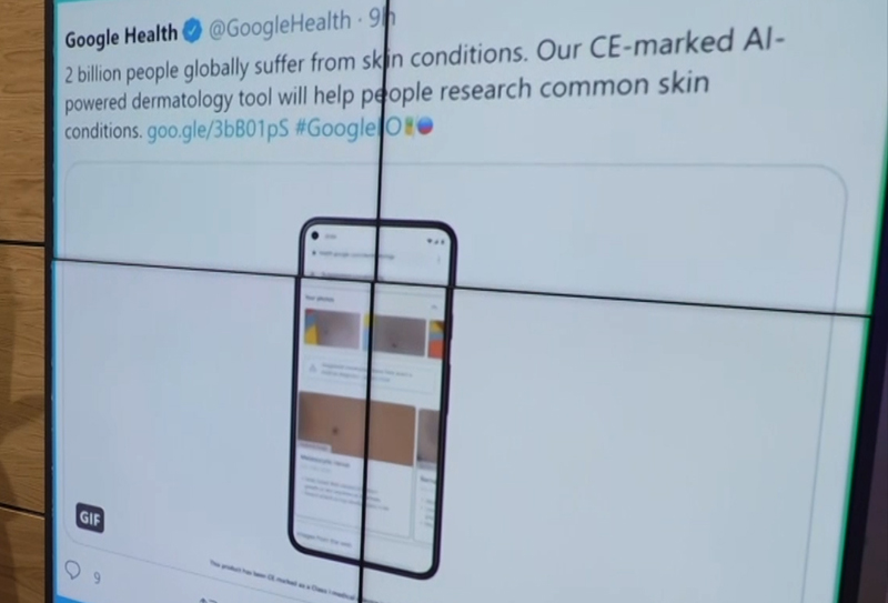 Google-ის ხელოვნური ინტელექტი, რომელიც კანის დაავადებებს ამოიცნობს