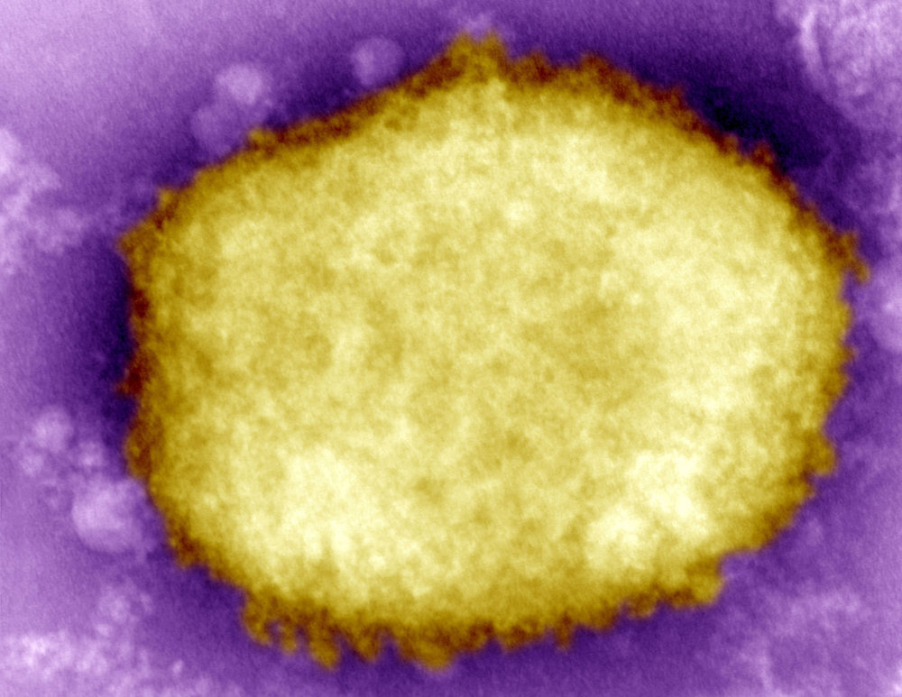 MONKEYPOX VIRUS